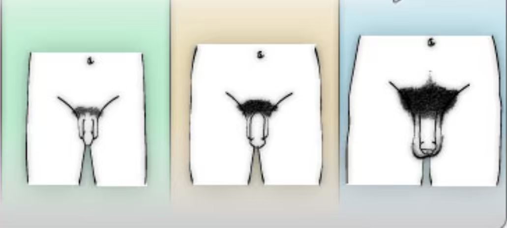 Three stages of improvement comparison